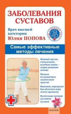 Юлия Попова - Заболевания суставов. Самые эффективные методы лечения - <a href=