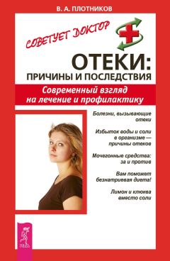 Виктор Плотников - Отеки: причины и последствия. Современный взгляд на лечение и профилактику - <a href=